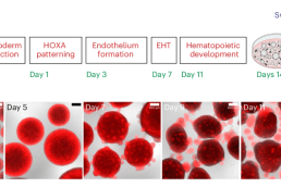 Прорыв в области трансплантологии, Журнал DonorSearch